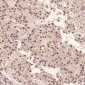 Anti-Ki67 MKI67 Rabbit Monoclonal Antibody